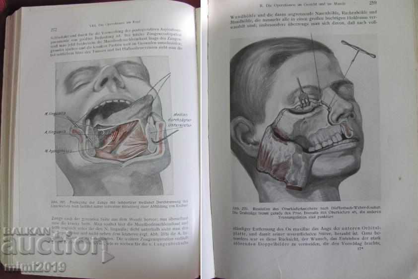 1930 Βιβλιοθήκη Der Chirurgische Operationskursus Γερμανία - 7 1930 Βιβλιοθήκη Der Chirurgische Operationskursus Γερμανία - 7