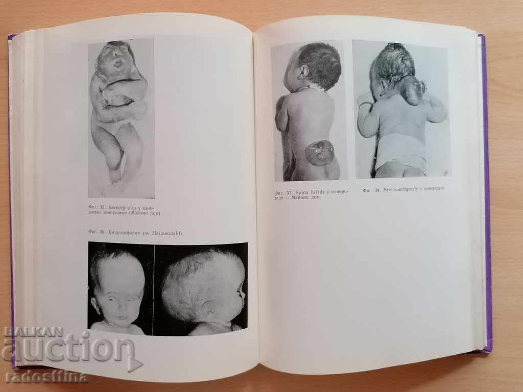 Newborn Diseases Bobev Iv. Ivanova 1970 with price 10.00 BGN | € 5.11 Newborn Diseases Bobev Iv. Ivanova 1970 with price 10.00 BGN | € 5.11