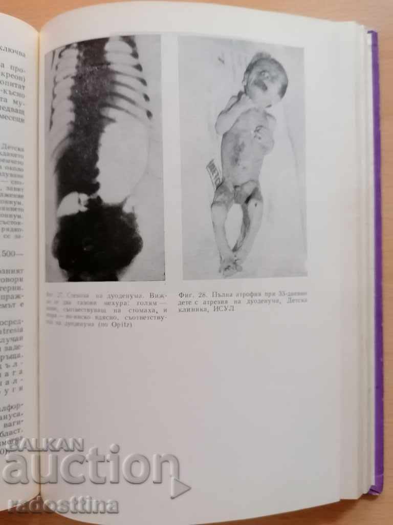 Newborn Diseases Bobev Iv. Ivanova 1970 - 5 Newborn Diseases Bobev Iv. Ivanova 1970 - 5