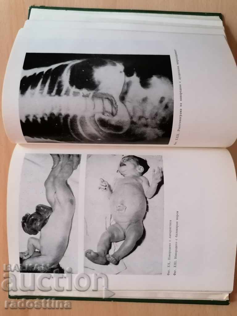 Остри хирургични заболявания на гръдния кош и корема с цена 10.00 лв. | € 5.11 Остри хирургични заболявания на гръдния кош и корема с цена 10.00 лв. | € 5.11