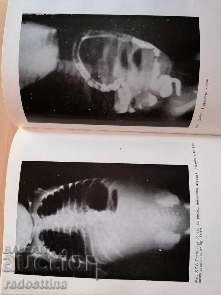 Аукцион Остри хирургични заболявания на гръдния кош и корема Аукцион Остри хирургични заболявания на гръдния кош и корема