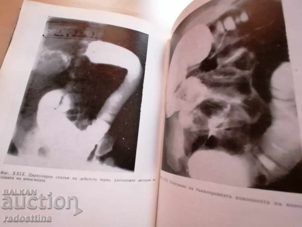 Остри хирургични заболявания на гръдния кош и корема - 6 Остри хирургични заболявания на гръдния кош и корема - 6