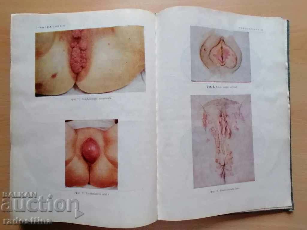 Gynecology Il. Storkalev - 5 Gynecology Il. Storkalev - 5