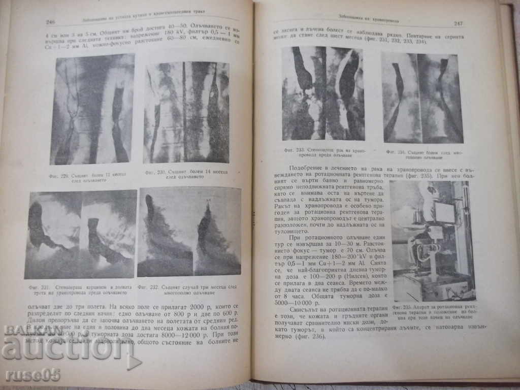 The book "X-ray therapy - Veselin Mikhailov" - 346 pages. - 5 The book "X-ray therapy - Veselin Mikhailov" - 346 pages. - 5