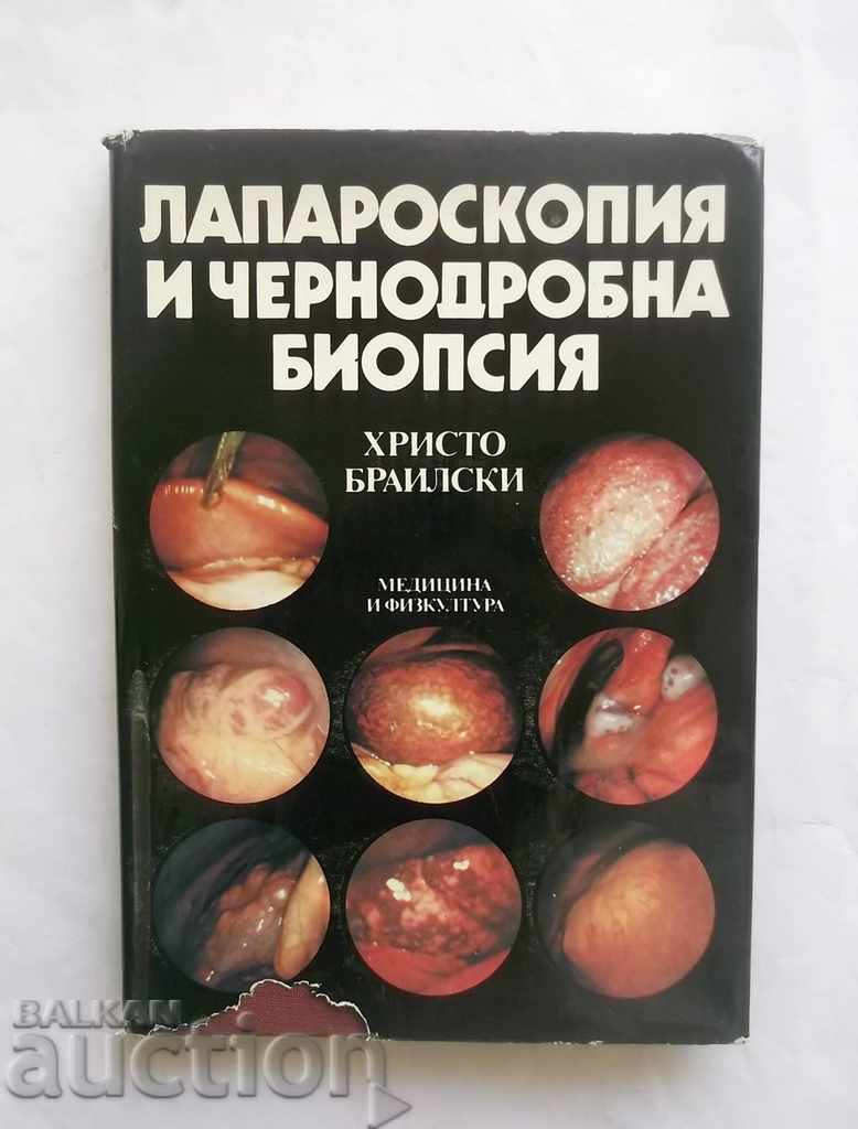 Laparoscopie și biopsie hepatică - Hristo Brailsky 1989