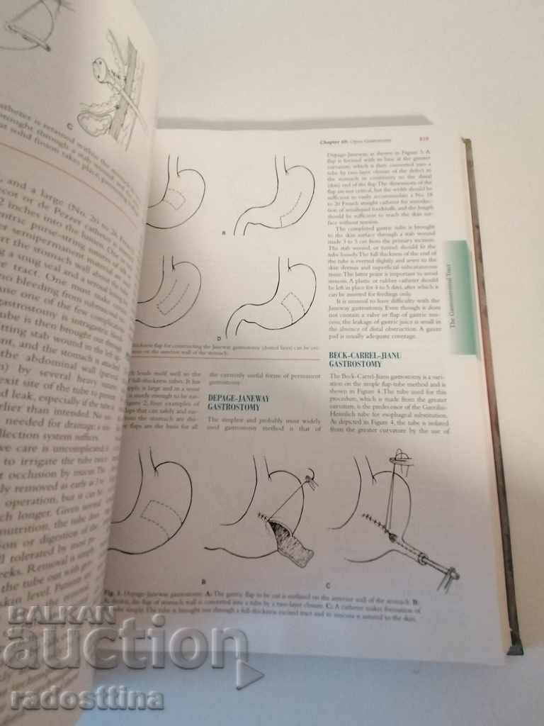 Delivery of Master of Surgery Josef Fischer 1 and 2