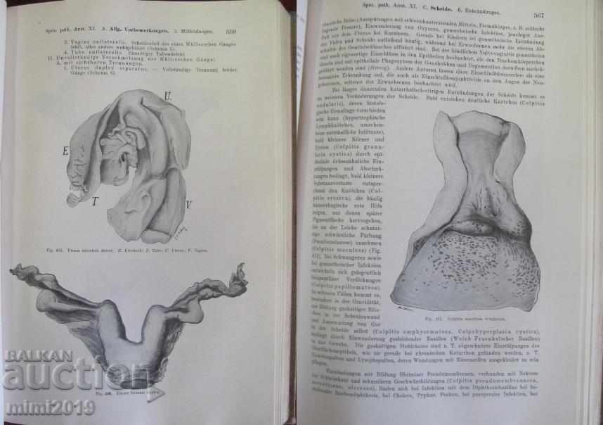 1923 Medical Book Pathological Anatomy Volume 2 Vienna - 5 1923 Medical Book Pathological Anatomy Volume 2 Vienna - 5