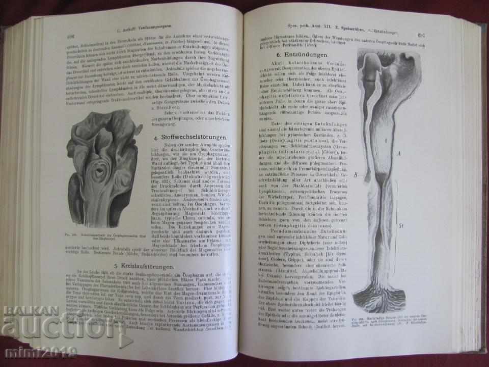 1923 Medical Book Pathological Anatomy Volume 2 Vienna - 6 1923 Medical Book Pathological Anatomy Volume 2 Vienna - 6