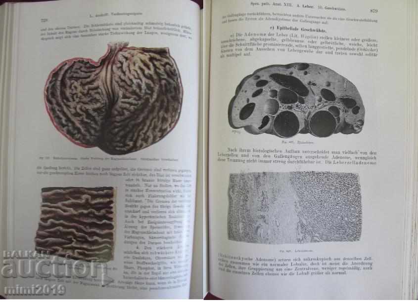 1923 Medical Book Pathological Anatomy Volume 2 Vienna - 7 1923 Medical Book Pathological Anatomy Volume 2 Vienna - 7