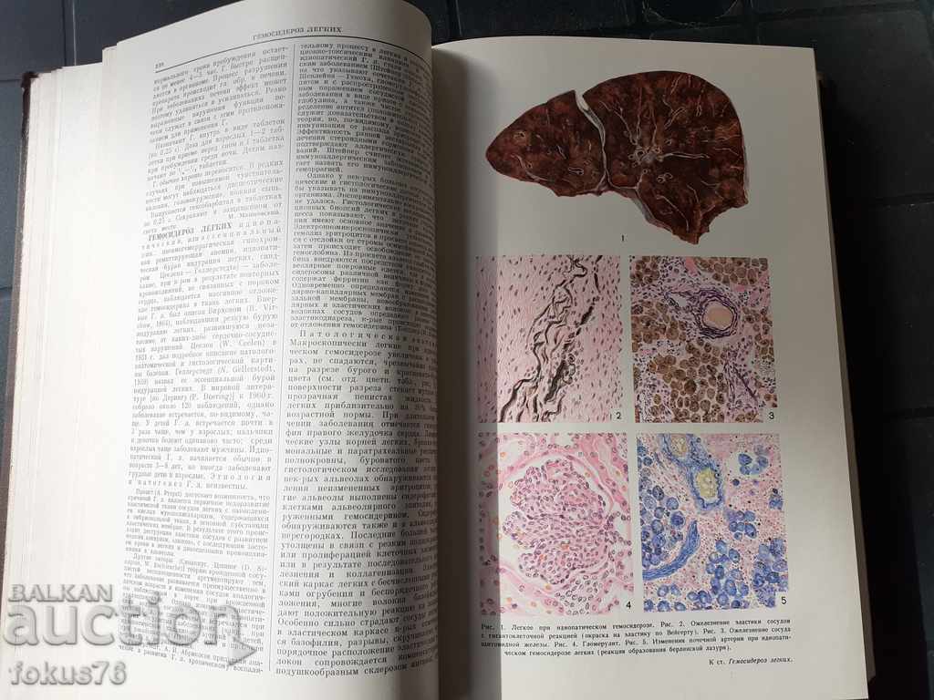 БОЛЬШАЯ МЕДИЦИНСКАЯ ЕНЦИКЛОПЕДИЯ - 5 БОЛЬШАЯ МЕДИЦИНСКАЯ ЕНЦИКЛОПЕДИЯ - 5