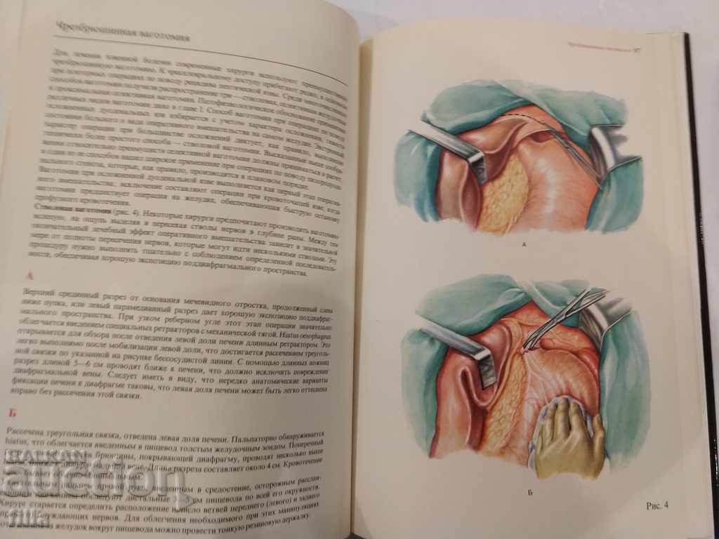 Auction Medicine, vagotomy Auction Medicine, vagotomy