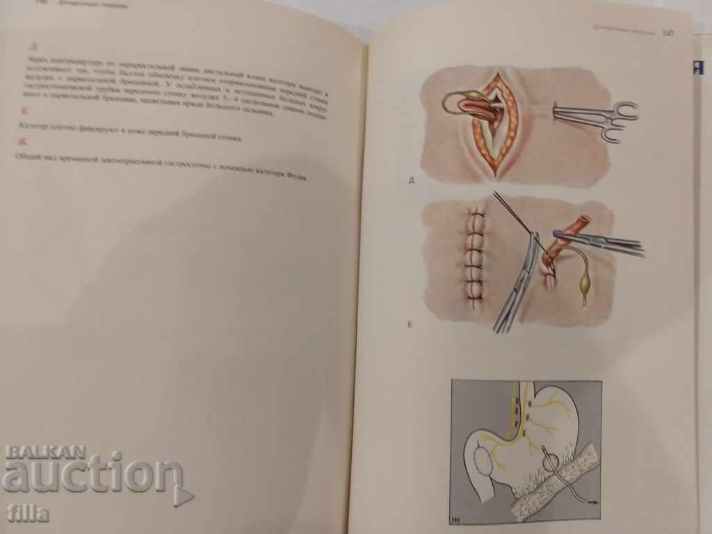 Delivery of Medicine, vagotomy Delivery of Medicine, vagotomy