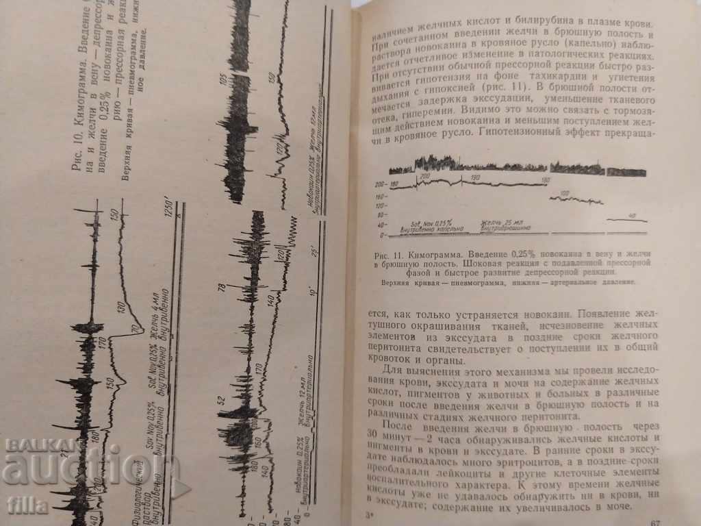 Delivery of Medicine, Bile peritonitis Delivery of Medicine, Bile peritonitis