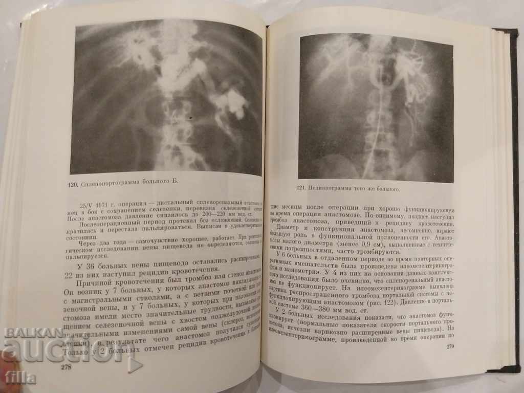 Auction Medicine, Surgery for portal hypertension Auction Medicine, Surgery for portal hypertension