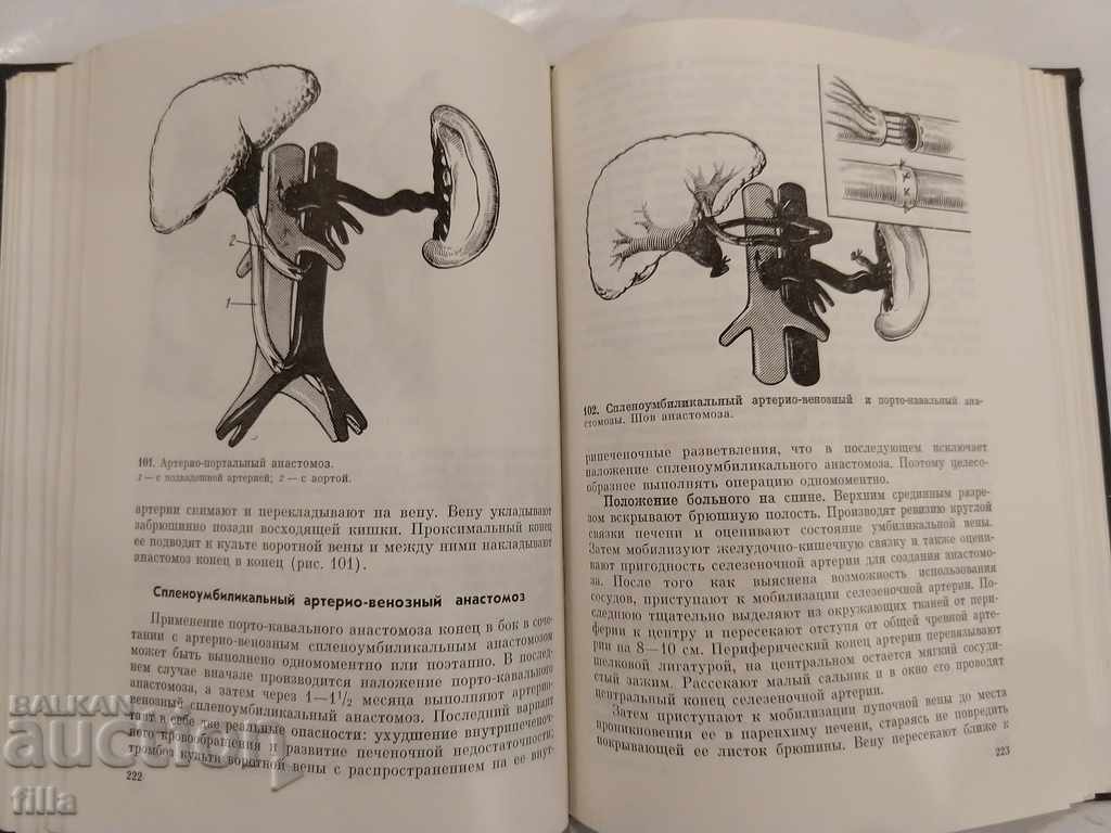 Delivery of Medicine, Surgery for portal hypertension Delivery of Medicine, Surgery for portal hypertension