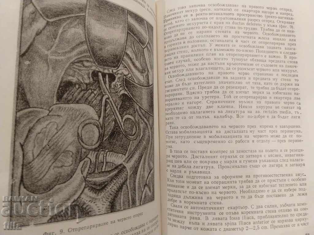 Auction Medicine, Colon Cancer Auction Medicine, Colon Cancer