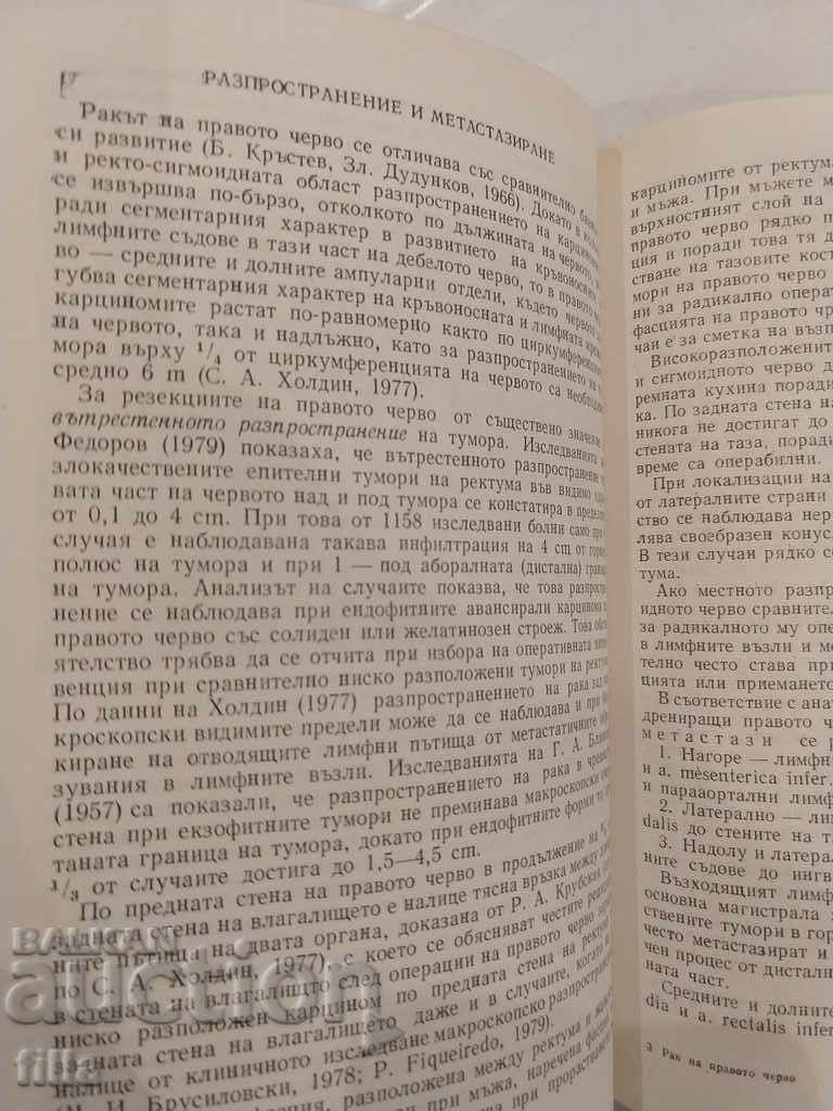 Medicine, Colon Cancer - 7 Medicine, Colon Cancer - 7