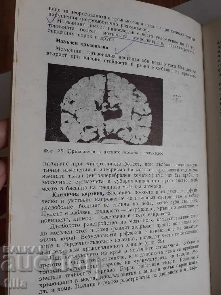 Medicine, Nervous Diseases - Nino Tsolov - 7 Medicine, Nervous Diseases - Nino Tsolov - 7