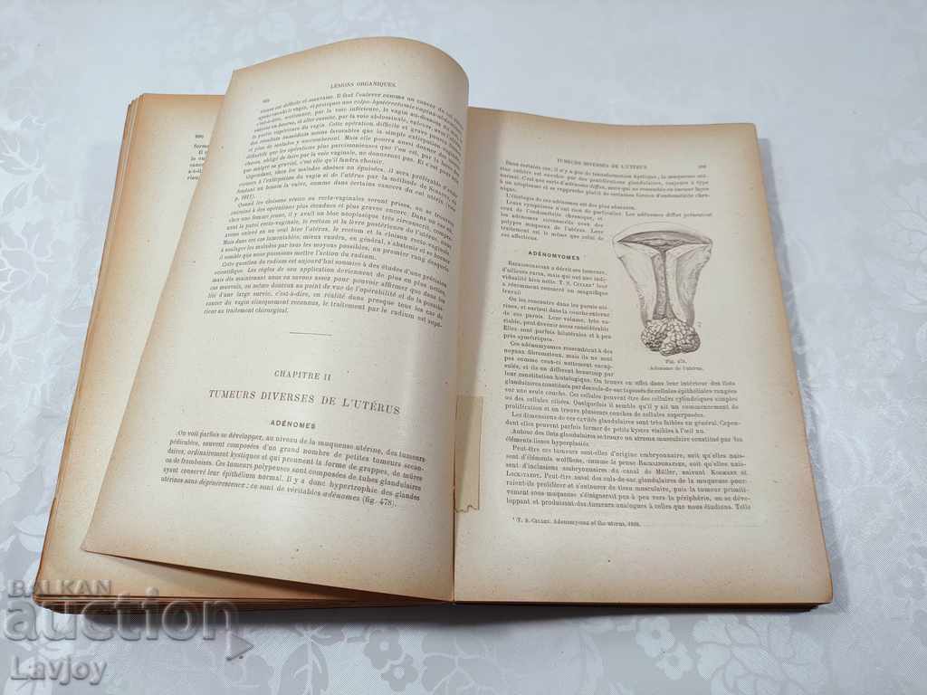 Delivery of Old ANTIQUE book GYNECOLOGY Medicine - 1923 Delivery of Old ANTIQUE book GYNECOLOGY Medicine - 1923