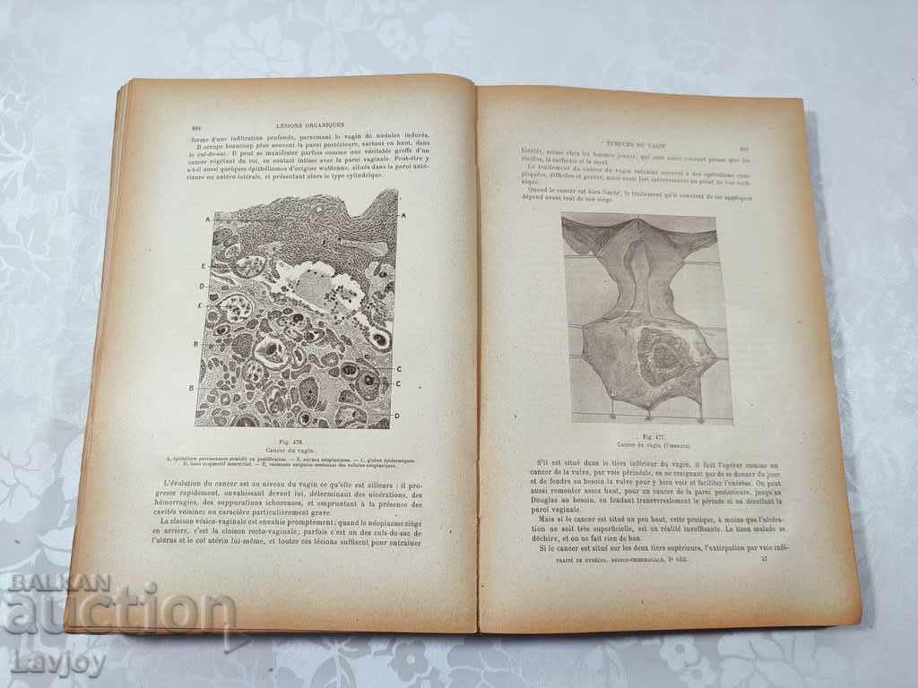 Old ANTIQUE book GYNECOLOGY Medicine - 1923 - 5 Old ANTIQUE book GYNECOLOGY Medicine - 1923 - 5