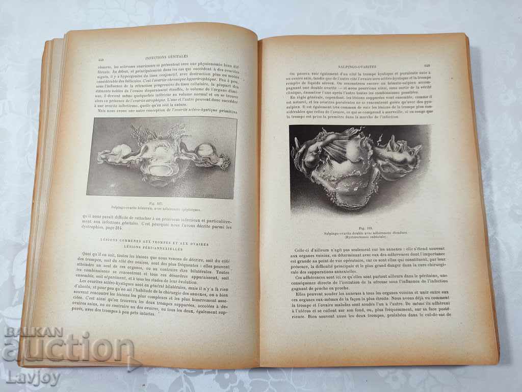 Old ANTIQUE book GYNECOLOGY Medicine - 1923 - 6 Old ANTIQUE book GYNECOLOGY Medicine - 1923 - 6