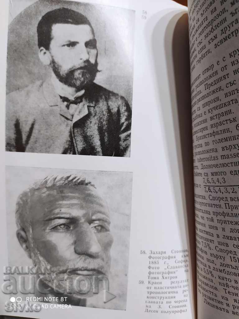 Unforgettable images Bone research of prominent historical l - 6 Unforgettable images Bone research of prominent historical l - 6