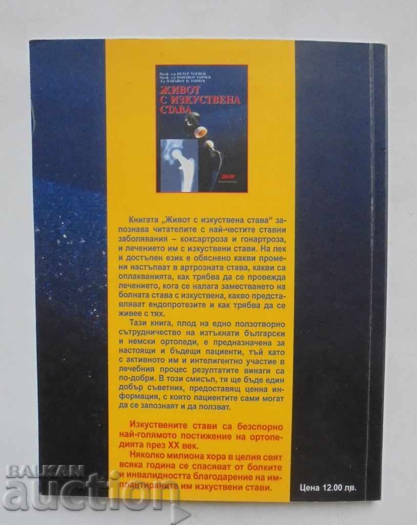Ζωή με τεχνητή άρθρωση - Peter Matzen, Panayot Tanchev 2019 με τιμή 20.00 BGN | € 10.23 Ζωή με τεχνητή άρθρωση - Peter Matzen, Panayot Tanchev 2019 με τιμή 20.00 BGN | € 10.23