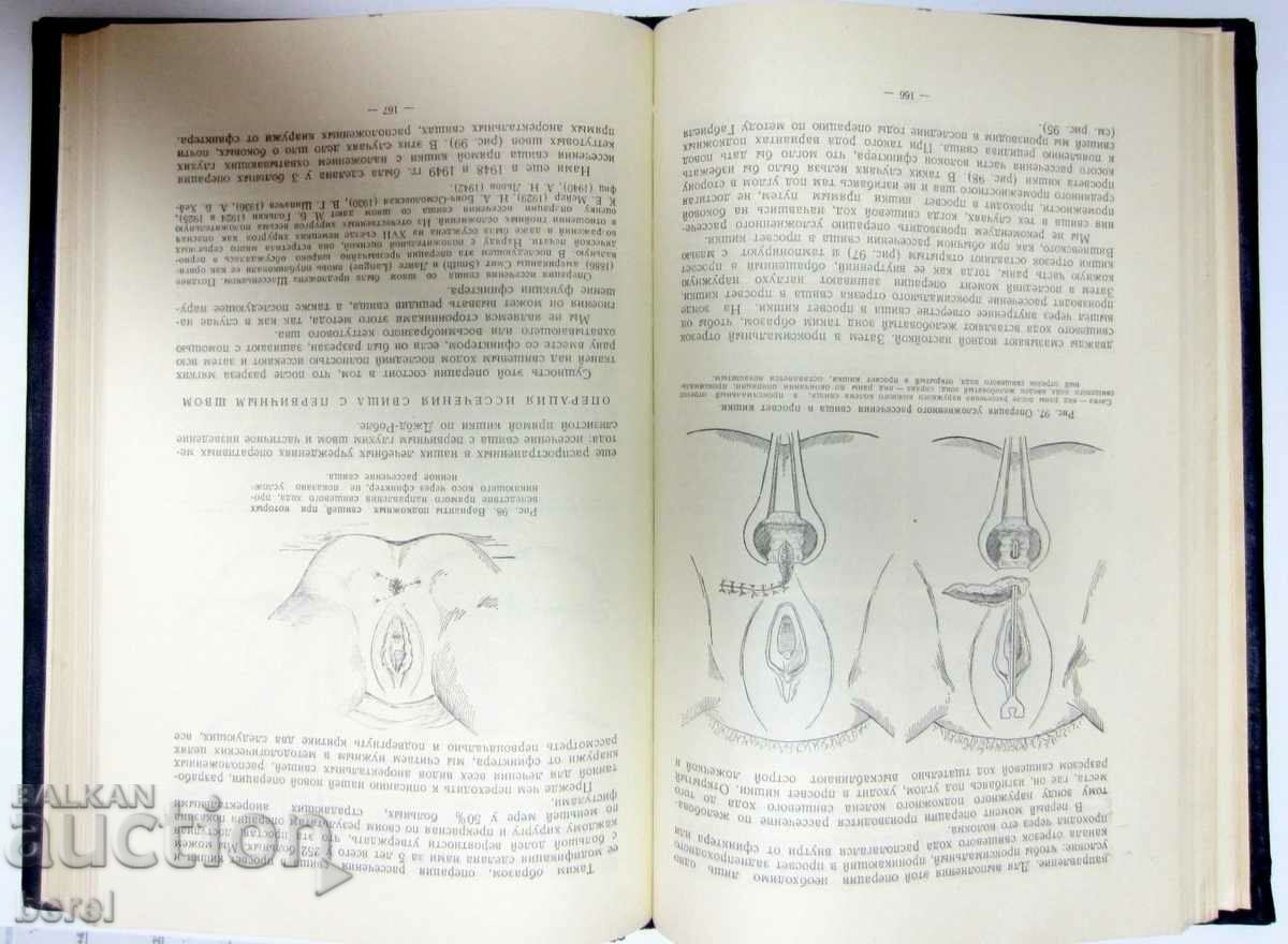 SURGERY-RECTAL SURGERY-MEDICINE-RUSSIAN-1956 - 6 SURGERY-RECTAL SURGERY-MEDICINE-RUSSIAN-1956 - 6