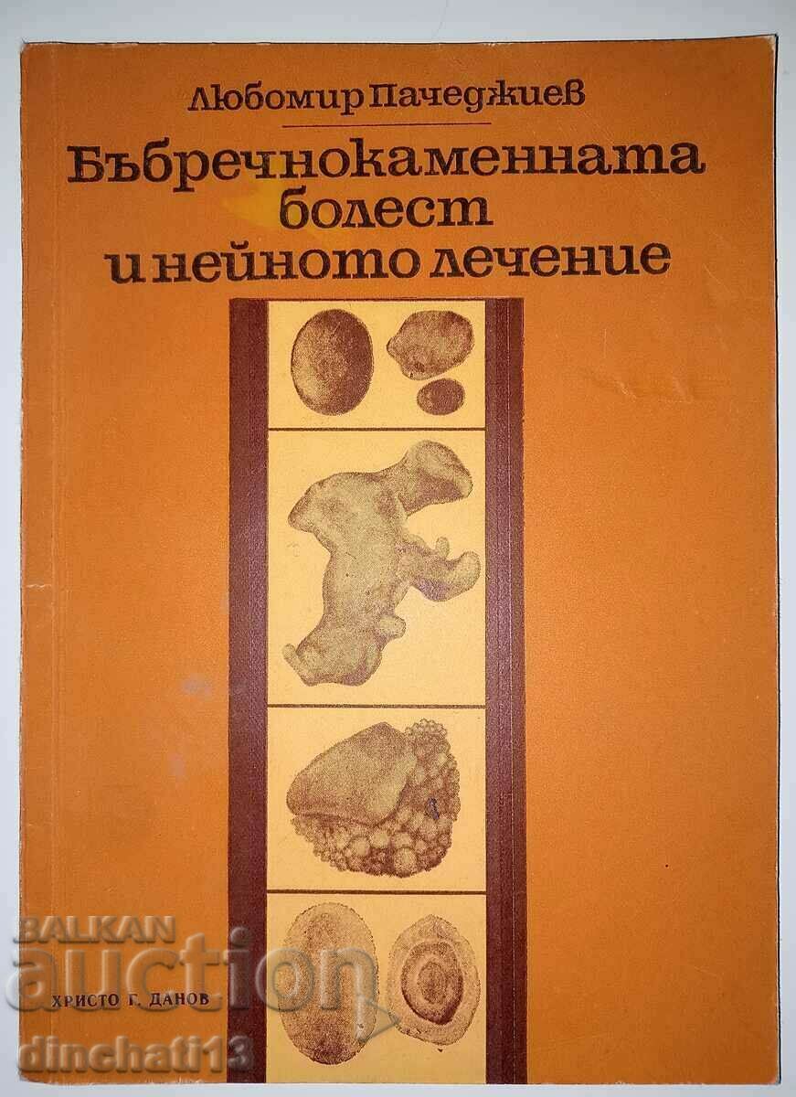 Νόσος της πέτρας στα νεφρά και η θεραπεία της: L. Pechedzhiev