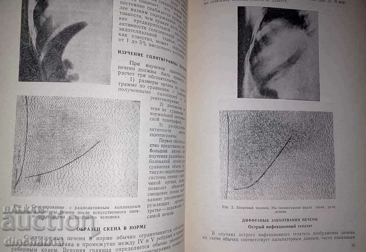 Auction Medical radioisotope scanning. Medgiz 1962 Auction Medical radioisotope scanning. Medgiz 1962