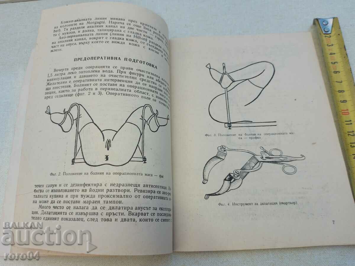 SURGERY OF THE ANUS AND RECTUM IN NON-CANCER DISEASES - 5 SURGERY OF THE ANUS AND RECTUM IN NON-CANCER DISEASES - 5
