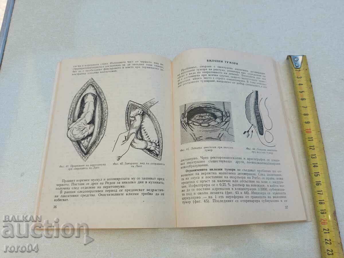 SURGERY OF THE ANUS AND RECTUM IN NON-CANCER DISEASES - 6 SURGERY OF THE ANUS AND RECTUM IN NON-CANCER DISEASES - 6