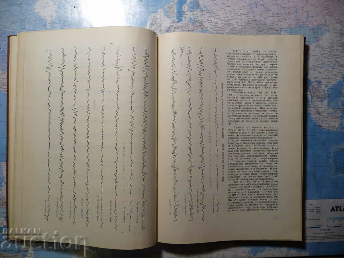 Alcoholic encephalopathies in childhood G. Uzunov, S. Bozh with price 25.00 BGN | € 12.78