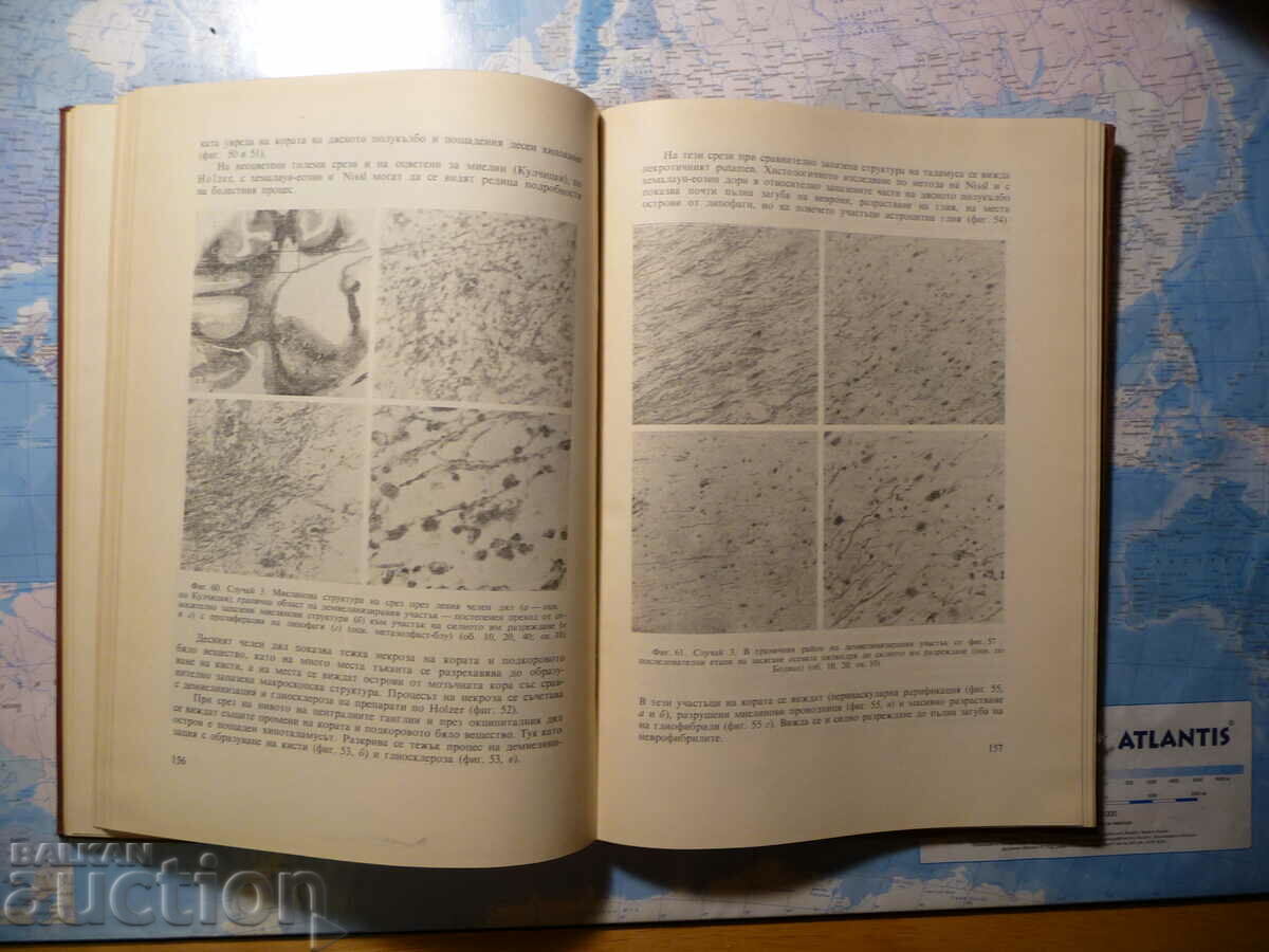 Auction  Alcoholic encephalopathies in childhood G. Uzunov, S. Bozh