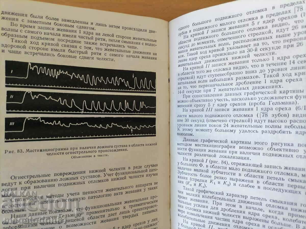 Φυσιολογία και παθοφυσιολογία (μάσημα και κατάποση) - Rubinov με τιμή 15.00 BGN | € 7.67 Φυσιολογία και παθοφυσιολογία (μάσημα και κατάποση) - Rubinov με τιμή 15.00 BGN | € 7.67