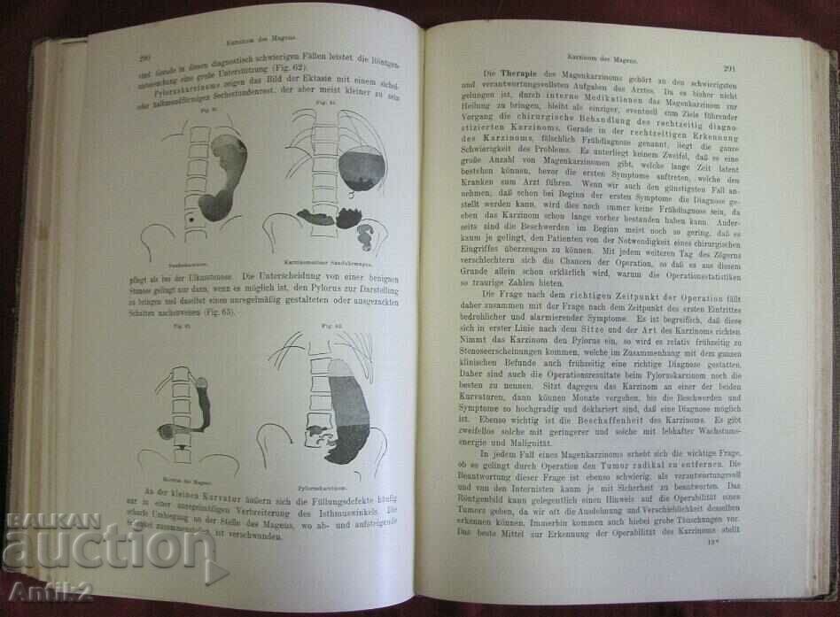 1923 Cartea medicala Germania - 6 1923 Cartea medicala Germania - 6