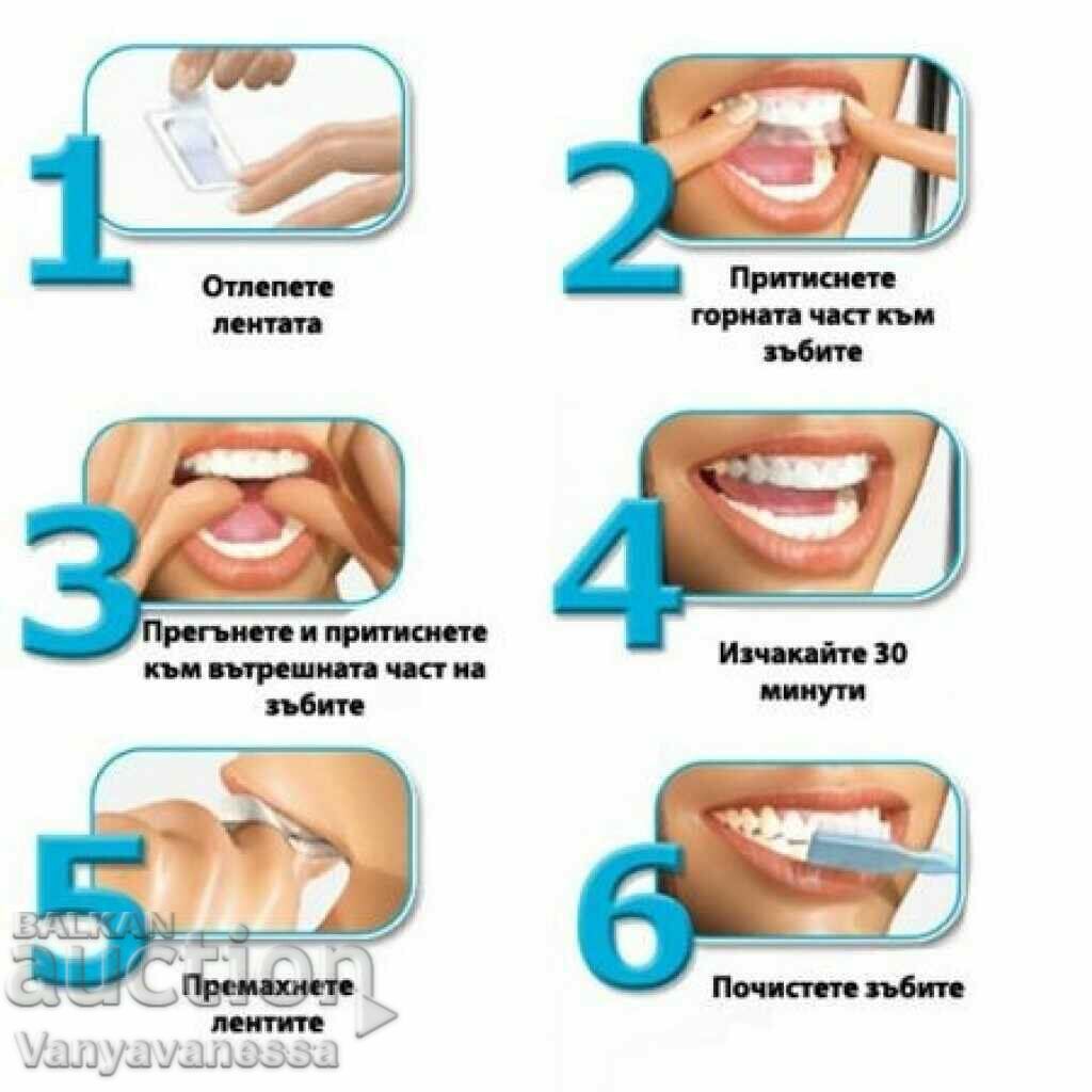 Auction  Advanced Teeth Whitening Strips