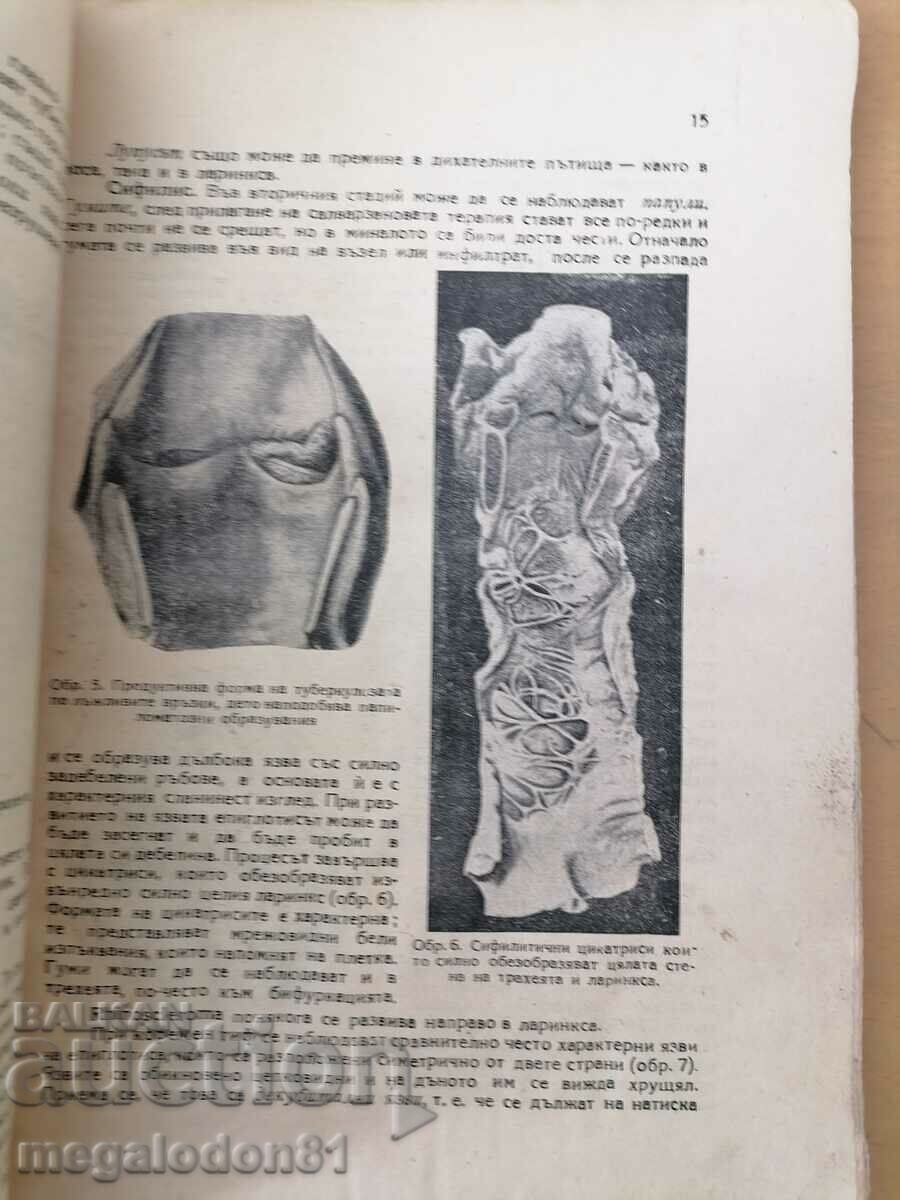 Special pathological anatomy, respiratory system, 1948. with price 35.00 BGN | € 17.90 Special pathological anatomy, respiratory system, 1948. with price 35.00 BGN | € 17.90