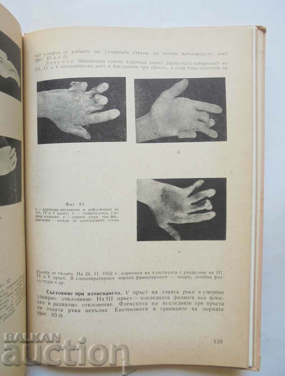 Auction  Skin plastic surgery for limb damage - Ts. Mihov 1960