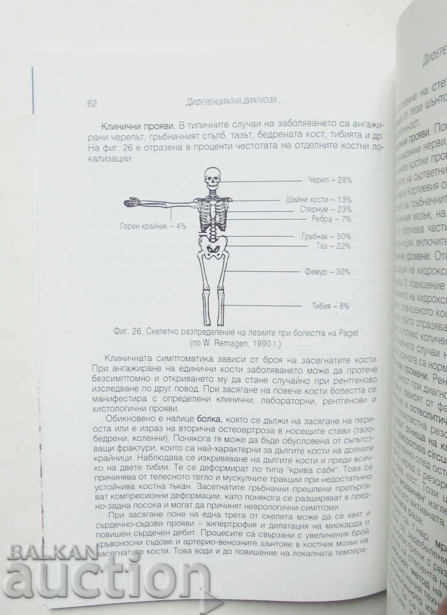 Delivery of Osteoporosis - Yordan Sheitanov 2000 Delivery of Osteoporosis - Yordan Sheitanov 2000