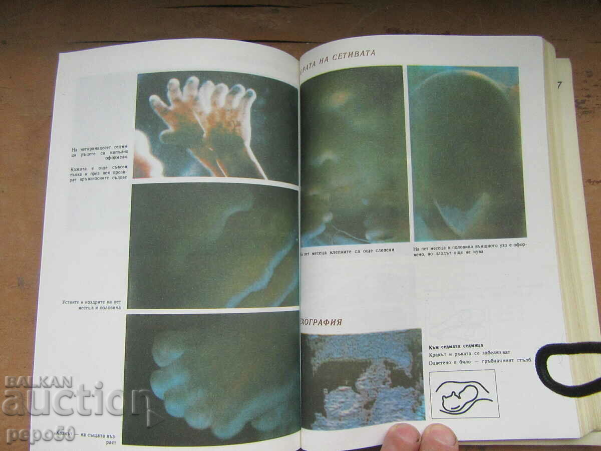 I'M EXPECTING A CHILD - Laurence Pernou - 1987 - 6 I'M EXPECTING A CHILD - Laurence Pernou - 1987 - 6