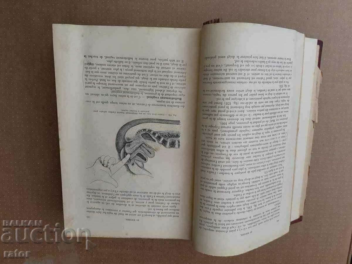 Delivery of Old textbook GYNECOLOGY 1900 - 1405 pages. RARE!!! Delivery of Old textbook GYNECOLOGY 1900 - 1405 pages. RARE!!!