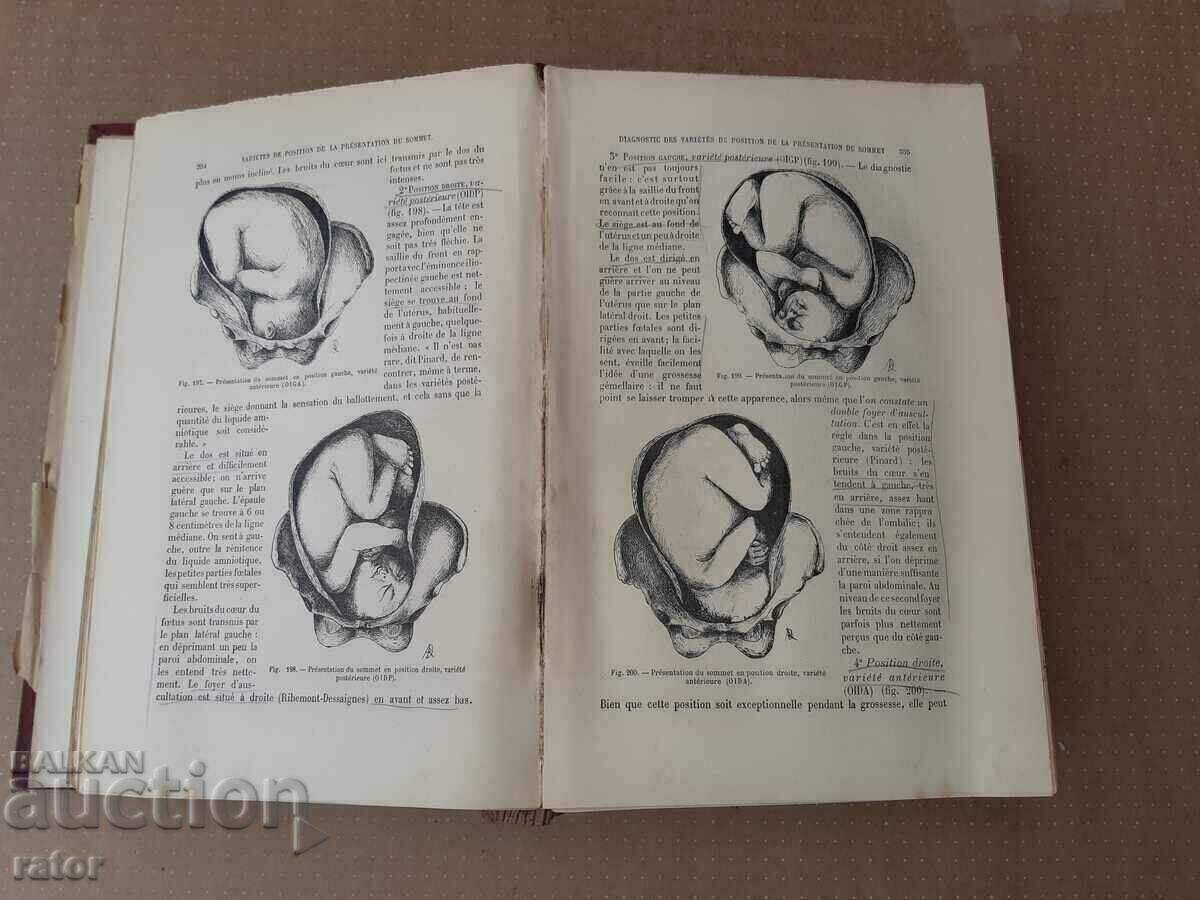 Old textbook GYNECOLOGY 1900 - 1405 pages. RARE!!! - 6 Old textbook GYNECOLOGY 1900 - 1405 pages. RARE!!! - 6