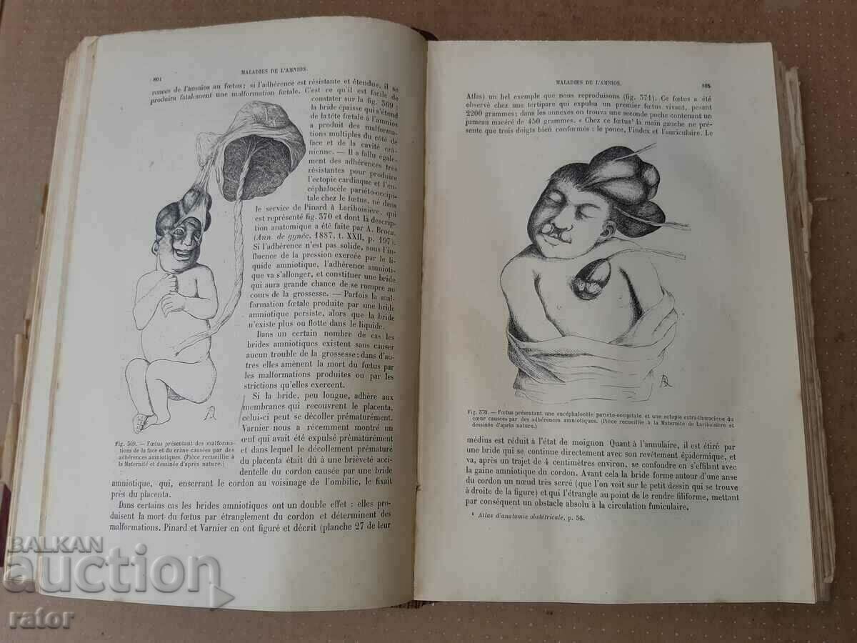 Old textbook GYNECOLOGY 1900 - 1405 pages. RARE!!! - 7 Old textbook GYNECOLOGY 1900 - 1405 pages. RARE!!! - 7