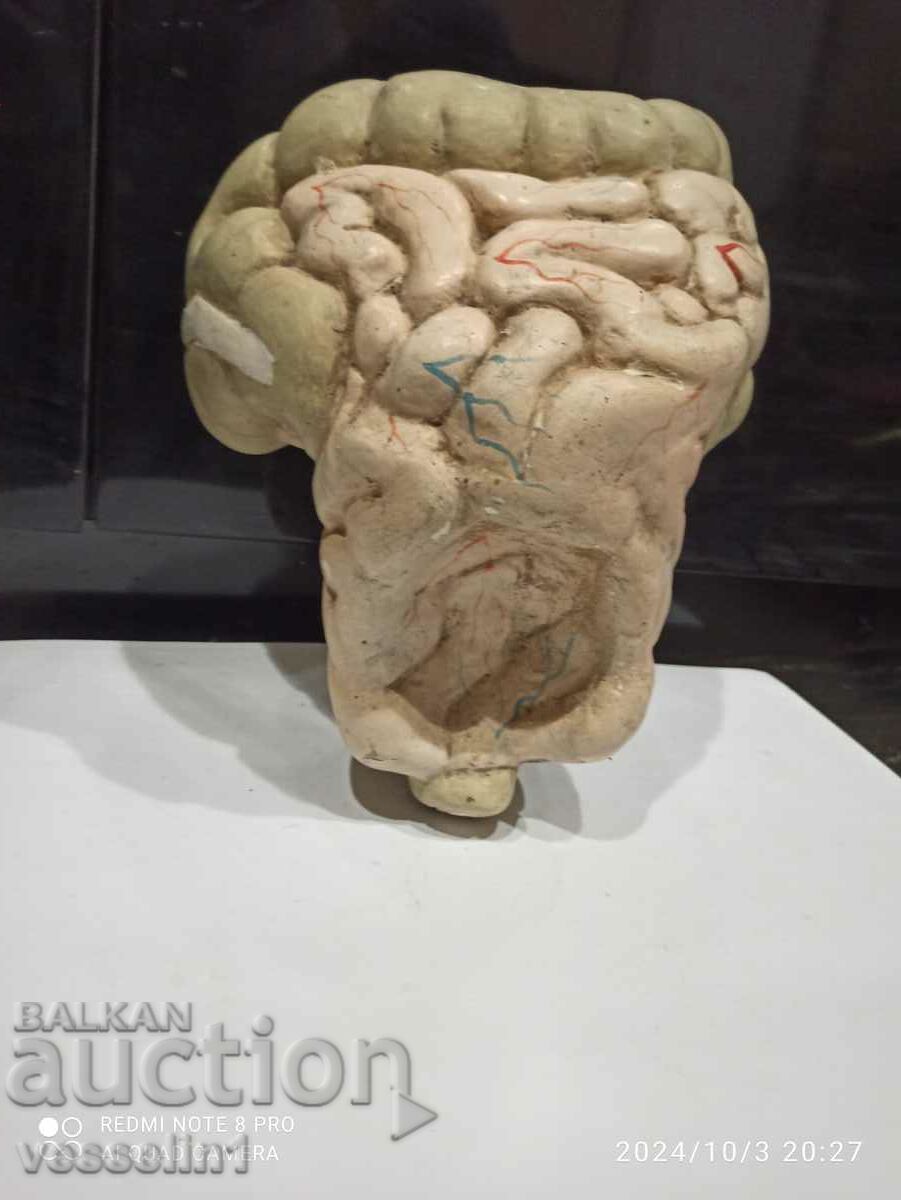 Anatomical model of the large intestine. 3-dimensional human model