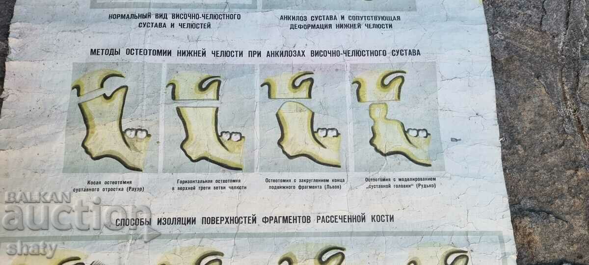 Доставка на Старо медицинско табло Доставка на Старо медицинско табло