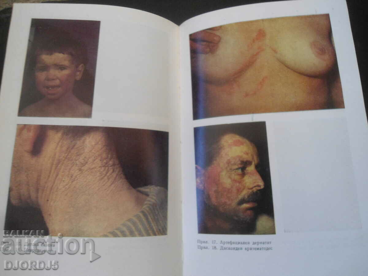 SKIN AND VENEREAL DISEASES with price 5.00 BGN | € 2.56 SKIN AND VENEREAL DISEASES with price 5.00 BGN | € 2.56
