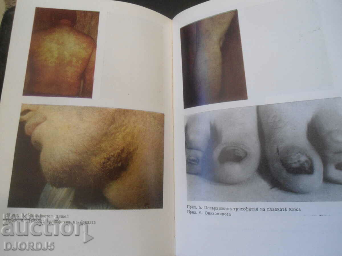 Auction SKIN AND VENEREAL DISEASES Auction SKIN AND VENEREAL DISEASES