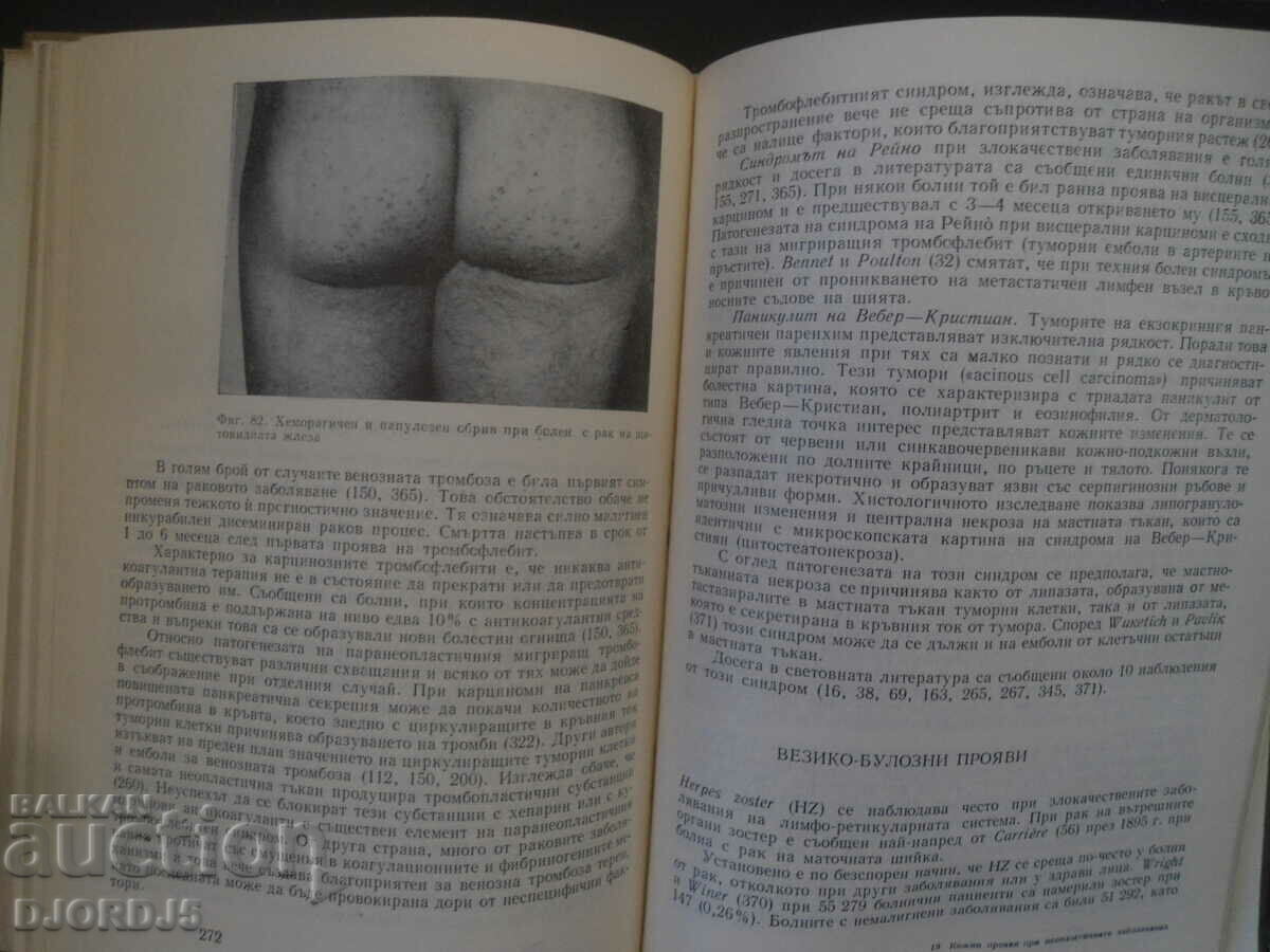 Auction SKIN MANIFESTATIONS IN NEOPLASTIC DISEASES Auction SKIN MANIFESTATIONS IN NEOPLASTIC DISEASES