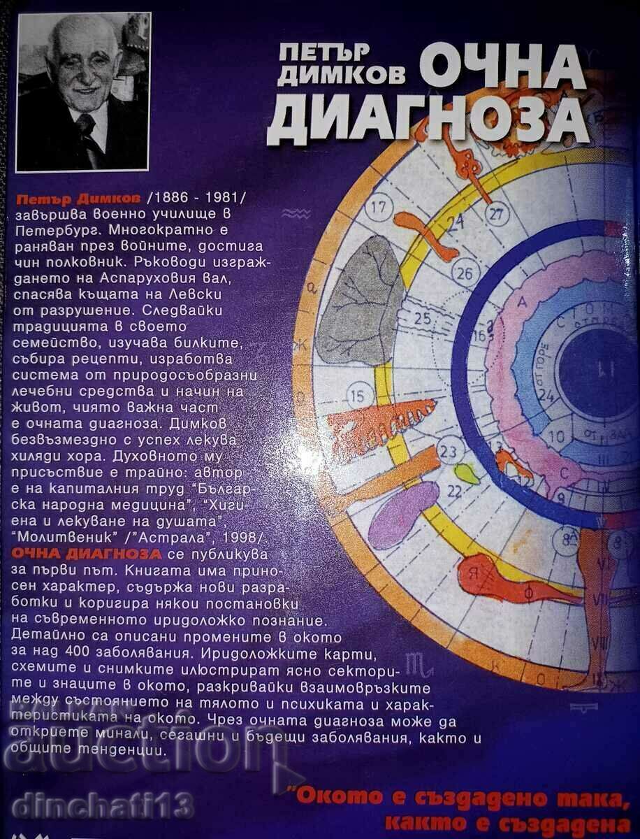 Eye diagnosis: Petar Dimkov - 5 Eye diagnosis: Petar Dimkov - 5